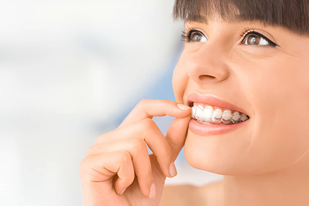 Taking Care of Your Invisalign: A Simple Guide